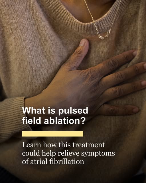 Fibrilația atrială: când ablația cu cateter poate fi o alternativă